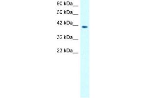 CHRNA1 antibody used at 1. (CHRNA1 anticorps)