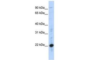 Image no. 1 for anti-Cysteine-Rich Protein 2 (CRIP2) (C-Term) antibody (ABIN6740380) (CRIP2 anticorps  (C-Term))