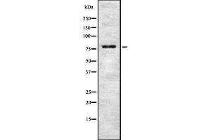 Western blot analysis of TSYL2 expression in HEK293 cells ,The lane on the left is treated with the antigen-specific peptide. (TSPY-Like 2 anticorps  (Internal Region))
