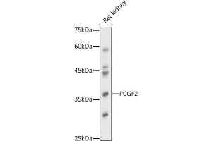 Western blot analysis of extracts of Rat kidney, using PCGF2 antibody (ABIN7269450) at 1:1000 dilution. (PCGF2 anticorps)