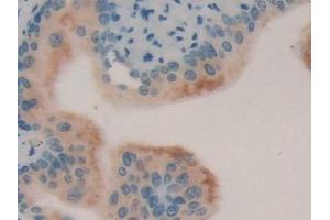 Detection of LCN8 in Mouse Vas Deferens Tissue using Polyclonal Antibody to Lipocalin 8 (LCN8)