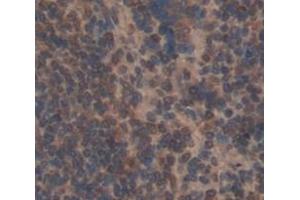 Figure. (PRDM1 anticorps  (AA 541-815))