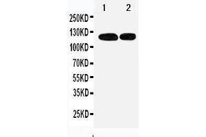 Anti-p107 antibody, Western blotting Lane 1: 239T Cell Lysate Lane 2: JURKAT Cell Lysate (p107 anticorps  (C-Term))
