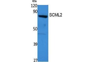 Western Blotting (WB) image for anti-Sex Comb On Midleg-Like 2 (SCML2) (Internal Region) antibody (ABIN3187657) (SCML2 anticorps  (Internal Region))