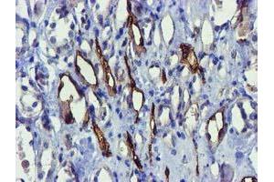 Immunohistochemistry (IHC) image for anti-Family with Sequence Similarity 84, Member B (FAM84B) antibody (ABIN1498212) (FAM84B anticorps)
