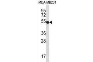Western blot analysis in MDA-MB231 cell line lysates (35ug/lane) using GPR34  Antibody .