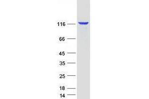 Validation with Western Blot
