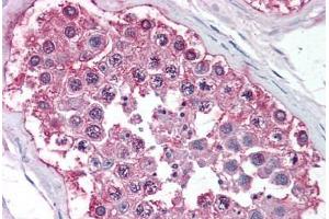 Human Testis (formalin-fixed, paraffin-embedded) stained with NR0B1 antibody ABIN213502 at 10 ug/ml followed by biotinylated goat anti-rabbit IgG secondary antibody ABIN481713, alkaline phosphatase-streptavidin and chromogen.
