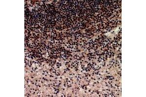 Immunohistochemical analysis of Telomerase staining in human spleen formalin fixed paraffin embedded tissue section. (TERT anticorps)