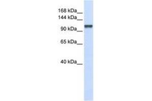 Image no. 1 for anti-Calcium Homeostasis Endoplasmic Reticulum Protein (CHERP) (C-Term) antibody (ABIN6740689) (CHERP anticorps  (C-Term))