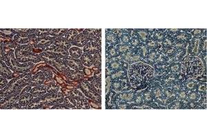 Expression of KCNJ1 in rat kidney - Immunohistochemical staining of rat kidney sections using Anti-KCNJ1 (Kir1.