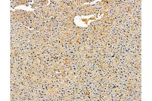 ABIN7096534 and ABIN7100598 at 1/100 staining mouse liver tissue by IHC-P.
