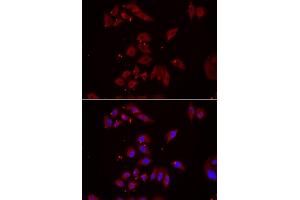 Immunofluorescence analysis of U2OS cells using NPHP1 antibody (ABIN5974022). (NPHP1 anticorps)