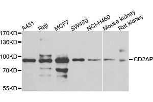 Western blot analysis of extracts of various cell lines, using CD2AP antibody. (CD2AP anticorps)