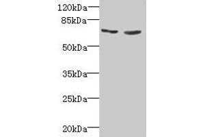 Western blot All lanes: TNFRSF11A antibody at 2 μg/mL Lane 1: EC109 whole cell lysate Lane 2: 293T whole cell lysate Secondary Goat polyclonal to rabbit IgG at 1/15000 dilution Predicted band size: 67, 33, 37, 29, 57, 65 kDa Observed band size: 67 kDa