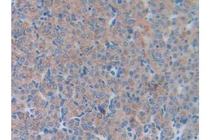 DAB staining on IHC-P; Samples: Mouse Ovary Tissue (LCN5 anticorps  (AA 28-187))