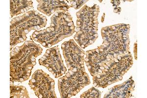 ABIN6260867 and ABIN6266510 at 1/100 staining Rat colon tissue by IHC-P. (Claudin 5 anticorps  (C-Term))