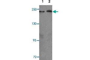 Western blot analysis of KLOTHO in rat heart tissue lysate with KL polyclonal antibody  at 1 ug/mL (lane 1) and 2 ug/mL (lane 2). (Klotho anticorps  (AA 410-460))