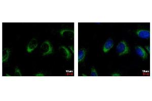 ICC/IF Image NQO2 antibody detects NQO2 protein at cytoplasm by immunofluorescent analysis.
