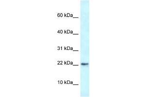 WB Suggested Anti-Rbm3 Antibody   Titration: 1. (RBM3 anticorps  (N-Term))