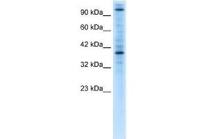 Human Jurkat; WB Suggested Anti-ZNF624 Antibody Titration: 0. (ZNF624 anticorps  (Middle Region))