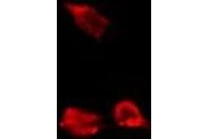 anti-Calpain, Small Subunit 1 (CAPNS1) (Internal Region) antibody