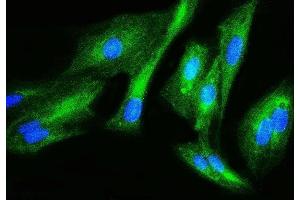 IF analysis of Filamin B/FLNB using anti-Filamin B/FLNB antibody (ABIN7601607).