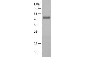 Western Blotting (WB) image for Golgin B1 (GOLGB1) (AA 3007-3192) protein (His-IF2DI Tag) (ABIN7123188) (Golgin B1 (GOLGB1) (AA 3007-3192) protein (His-IF2DI Tag))