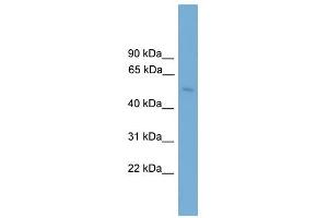 BBS4 antibody used at 1 ug/ml to detect target protein. (BBS4 anticorps  (Middle Region))