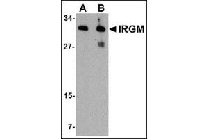 Western blot analysis of IRGM in human brain lysate with this product at (A) 1 and (B) 2 μg/ml. (IRGM anticorps  (Center))