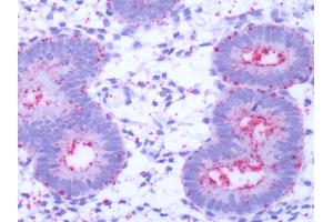 Human Uterus, Endometrium: Formalin-Fixed, Paraffin-Embedded (FFPE)