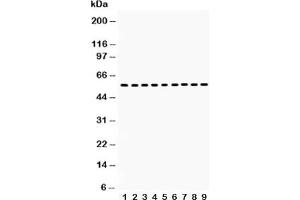 Western blot testing of Vimentin antibody and Lane 1:  HT1080;  2: NIH3T3;  3: Jurkat;  4: HUT;  5: MCF-7;  6: HeLa;  7: human placenta;  8: rat testis;  9: mouse testis lysate (Vimentin anticorps  (C-Term))
