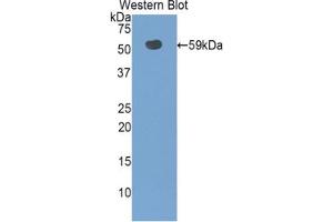 Western blot analysis of the recombinant protein. (SLC3A2 anticorps  (AA 282-523))