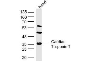 Mouse heart lysates probed with Rabbit Anti-Troponin T Polyclonal Antibody, Unconjugated  at 1:500 for 90 min at 37˚C.