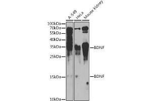 Western blot analysis of extracts of various cell lines, using BDNF antibody (ABIN6129991, ABIN6137522, ABIN6137524 and ABIN6215043) at 1:1000 dilution. (BDNF anticorps  (AA 20-247))