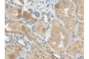 Detection of CRP in Human Kidney Tissue using Polyclonal Antibody to C Reactive Protein (CRP) (CRP anticorps  (AA 17-224))