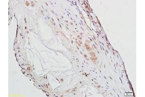 Formalin-fixed and paraffin embedded rat aorta tissue labeled with Anti-PPAR Gamma Polyclonal Antibody, Unconjugated (ABIN1386283) at 1:300 followed by conjugation to the secondary antibody (PPARG anticorps  (AA 315-420))