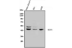 Western blot analysis of Mesp2 using anti-Mesp2 antibody (ABIN7599353).