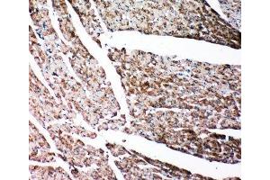 IHC-P: Gelsolin antibody testing of rat heart tissue
