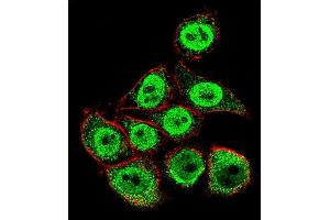 Confocal immunofluorescent analysis of TYSY Antibody (C-term) (ABIN1882144 and ABIN2840937) with Hela cell followed by Alexa Fluor 488-conjugated goat anti-rabbit lgG (green). (TYMS anticorps  (C-Term))