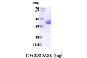 SDS-PAGE (SDS) image for RCD1 Required For Cell Differentiation1 Homolog (RQCD1) (AA 1-299) protein (His tag) (ABIN667268)