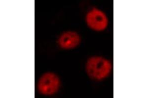ABIN6269101 staining MOLT by IF/ICC. (Retinoblastoma 1 anticorps  (C-Term))