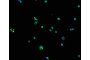 Immunofluorescence staining of MCF-7 cells with ABIN7168807 at 1:100, counter-stained with DAPI.