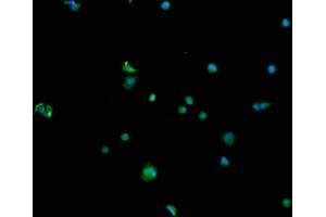Immunofluorescence staining of MCF-7 cells with ABIN7168807 at 1:100, counter-stained with DAPI. (SEMA4F anticorps  (AA 417-659))