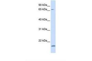 Image no. 1 for anti-Zinc Finger Protein 398 (ZNF398) (N-Term) antibody (ABIN6737899) (ZNF398 anticorps  (N-Term))