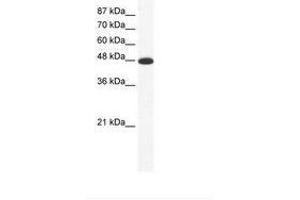 Image no. 1 for anti-Amiloride-Sensitive Cation Channel 5, Intestinal (ACCN5) (AA 201-250) antibody (ABIN202676) (ACCN5 anticorps  (AA 201-250))