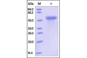 Human CD99, Fc Tag on SDS-PAGE under reducing (R) condition. (CD99 Protein (CD99) (AA 23-122) (Fc Tag))