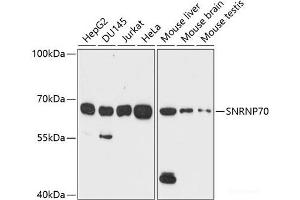 Western blot analysis of extracts of various cell lines using SNRNP70 Polyclonal Antibody at dilution of 1:1000. (SNRNP70 anticorps)