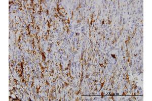Immunoperoxidase of monoclonal antibody to SCGN on formalin-fixed paraffin-embedded human yolk sac tumor.