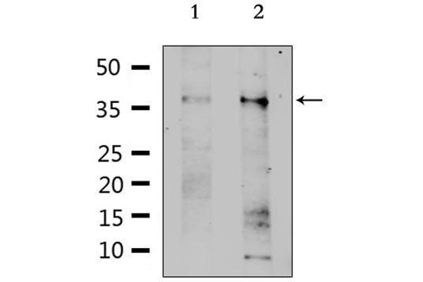 SLC39A1 antibody  (Internal Region)